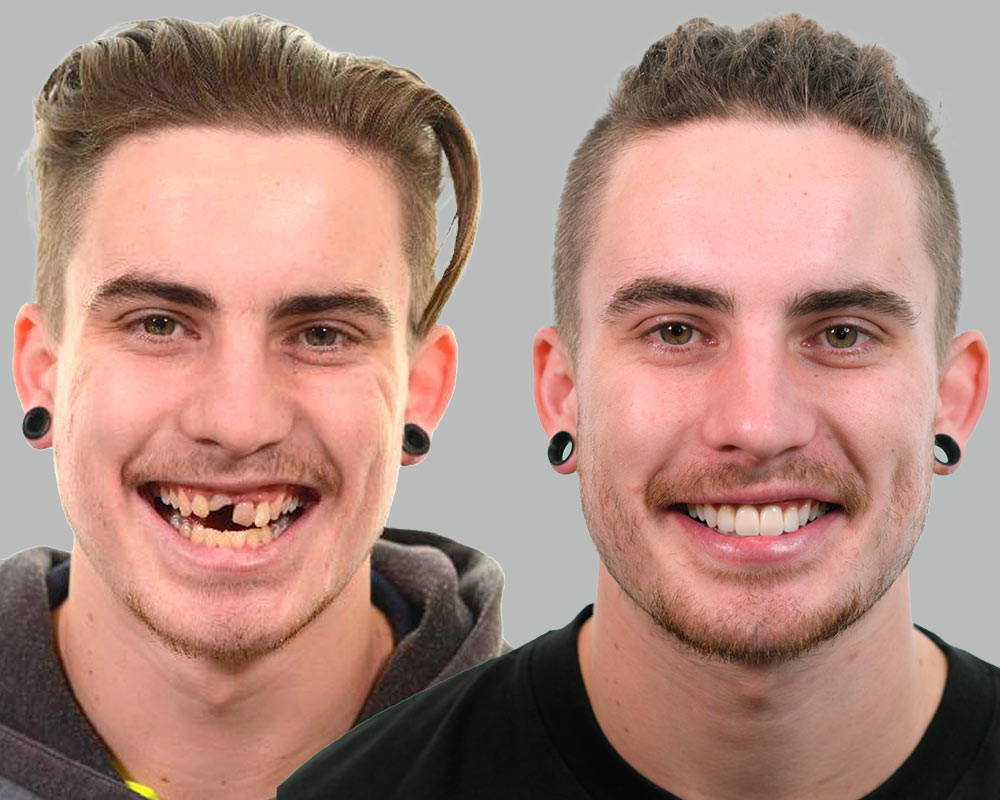 Jake-Restorative-Before and After