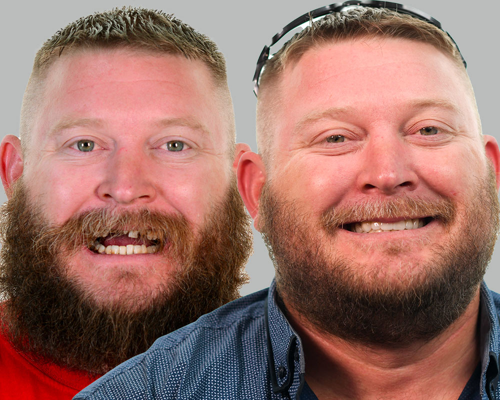Stephen-Restorative-Before and After