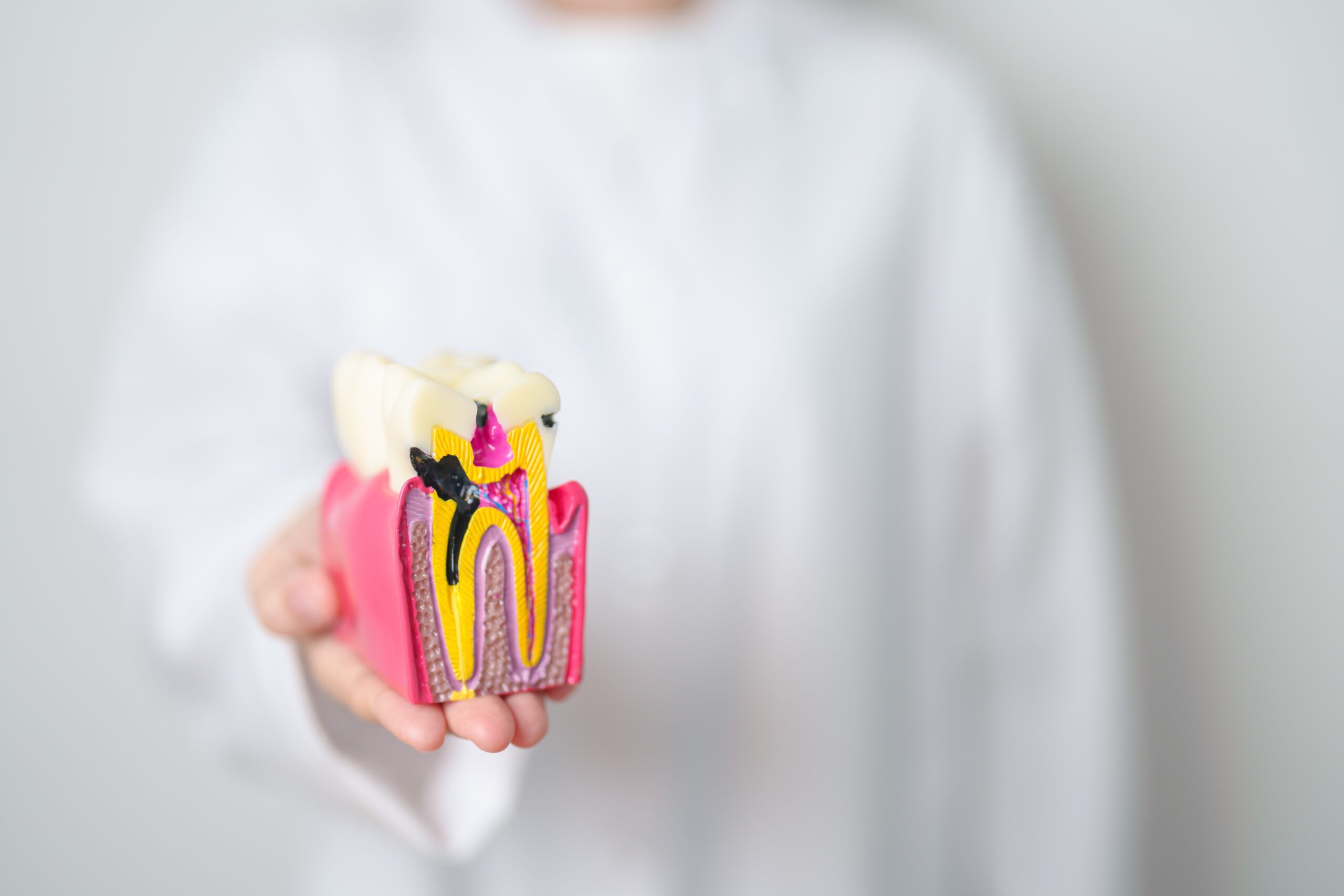 What Causes Tooth Decay