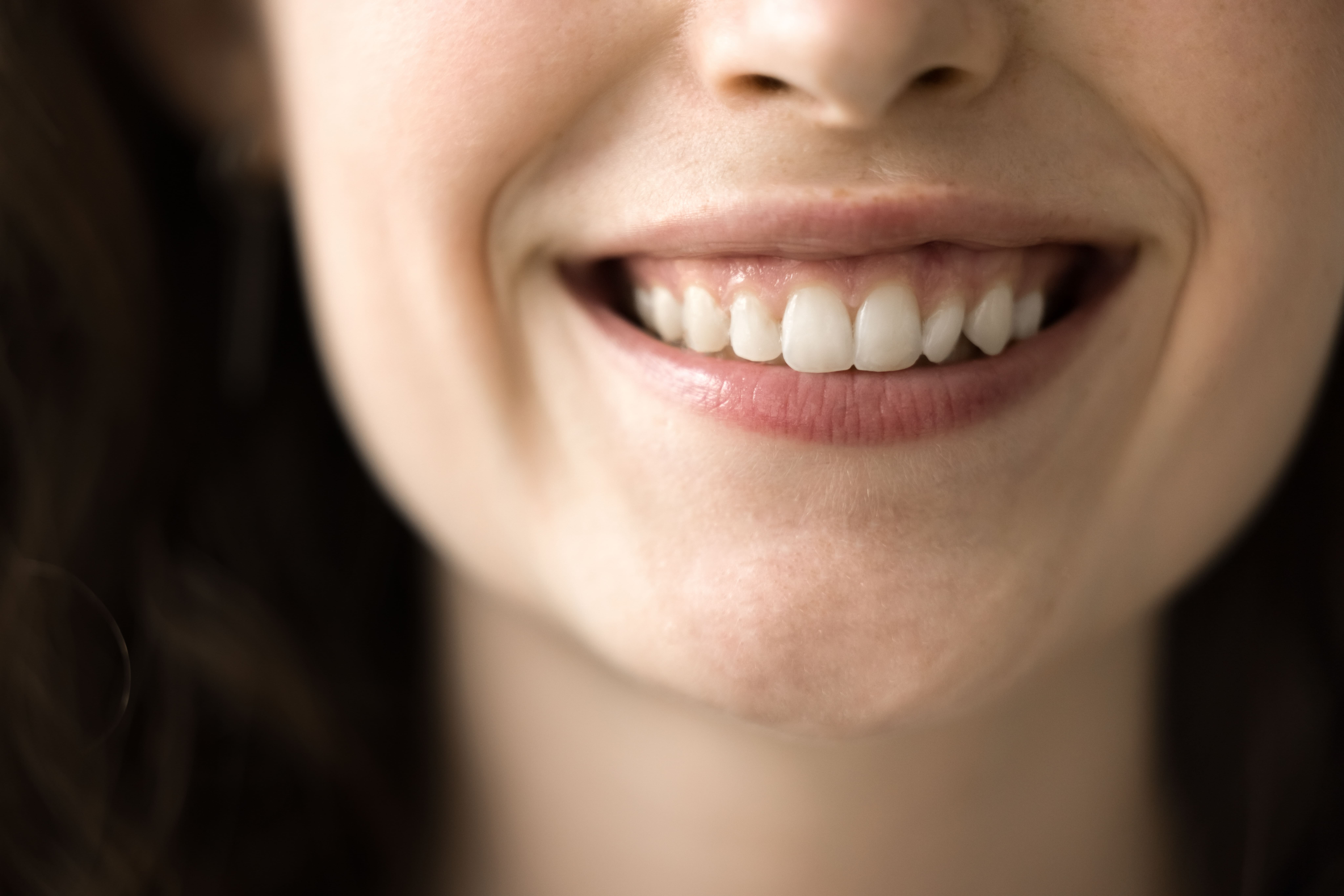 Can a Gummy Smile be Corrected
