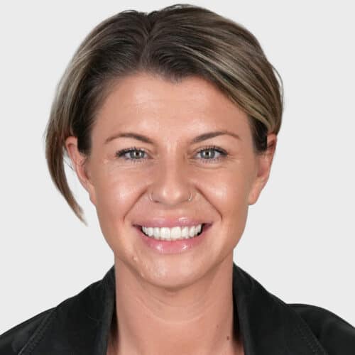 Dental implants providing a fixed solution for missing teeth, including single, multiple, and full mouth implants, custom designed for precision, function, and aesthetics