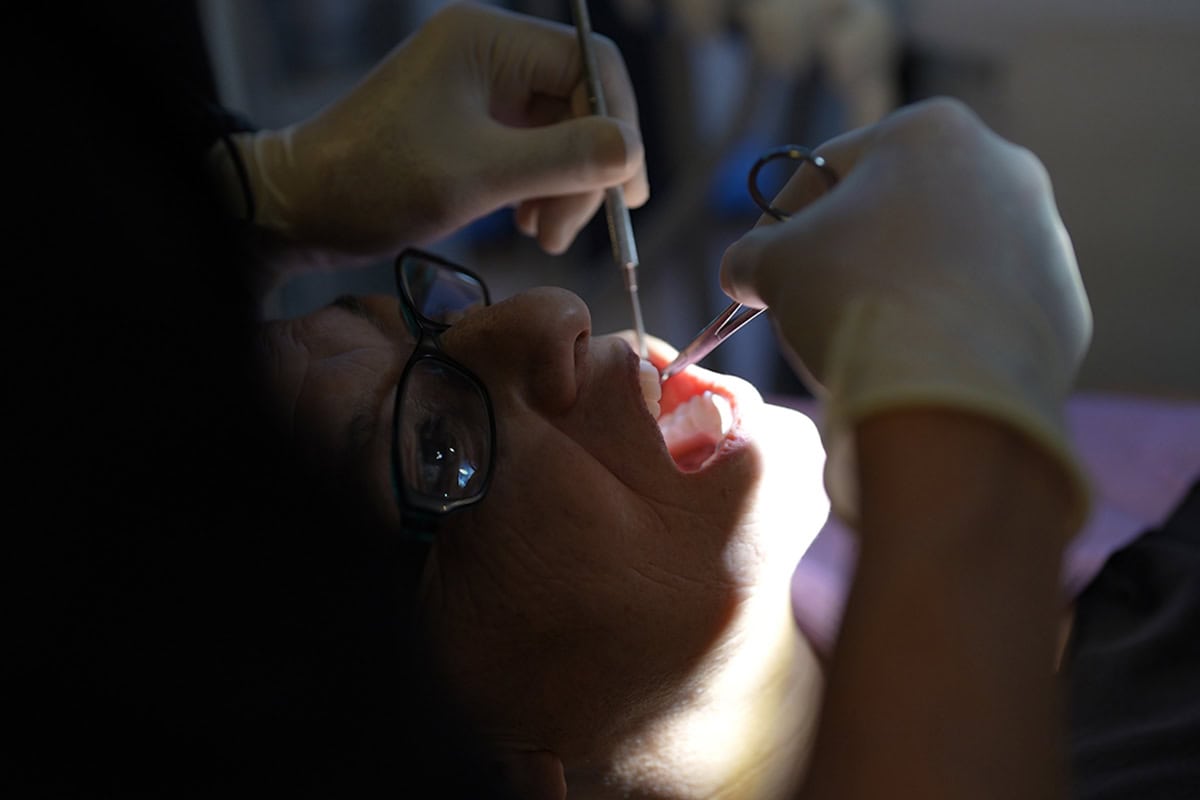 Patient consultation for All-on-4 treatment, with significant tooth loss, damaged or ill-fitting dentures, and difficulty chewing or smiling, seeking a long-term full-arch dental solution.