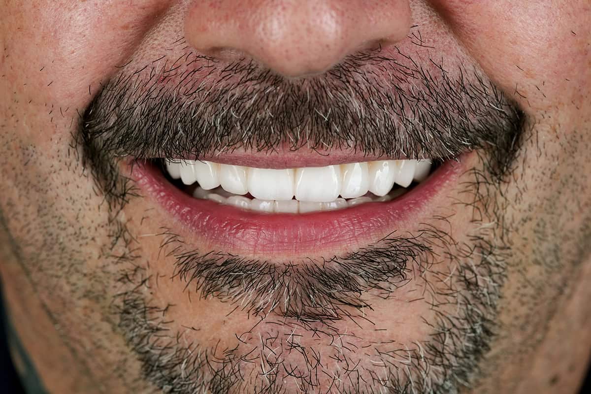 Why avoiding dental treatment makes things harder