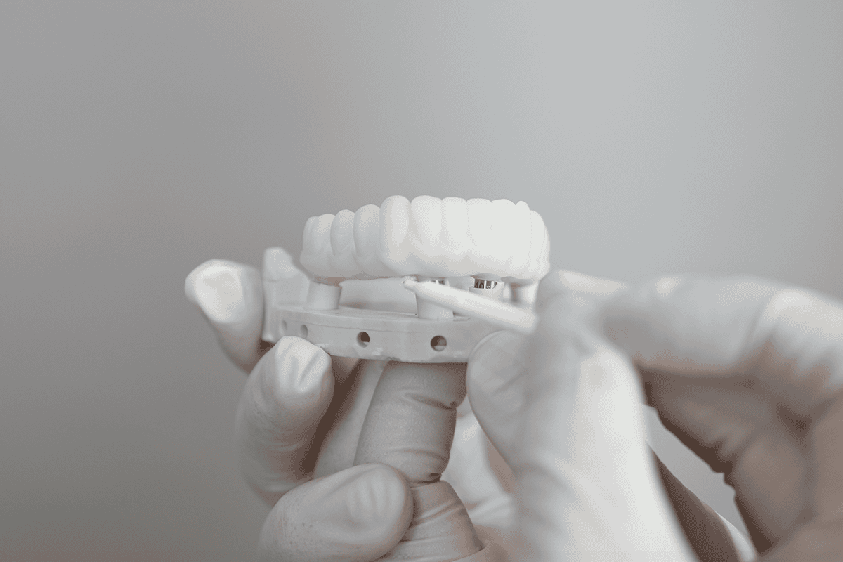 What to do after full mouth reconstruction follow your post-op plan, keep in touch with your dental team, and rest with proper hydration.