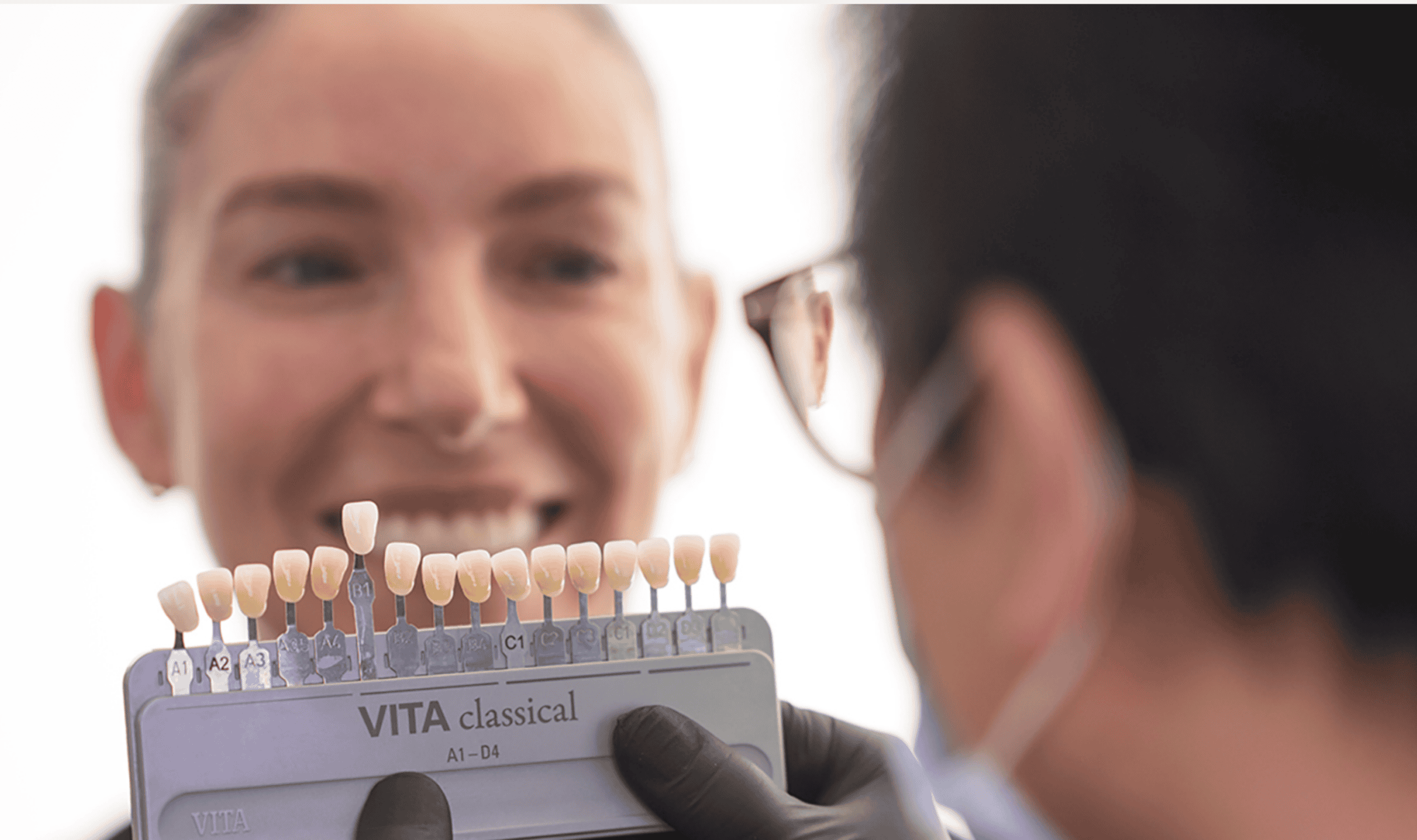 What are porcelain veneers?