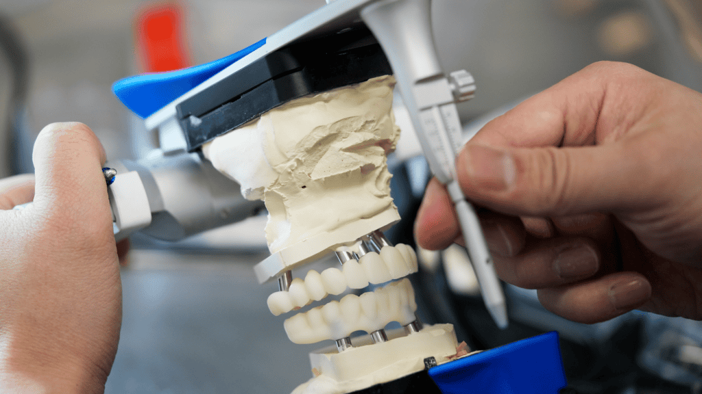 Zirconia Bridges: The Material Used in Full Arch Replacement