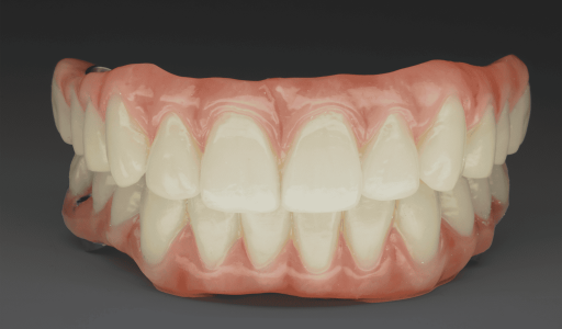 A04_UpperLowerBridge-1536x1025