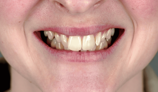 CrookedGrind-2048x1365