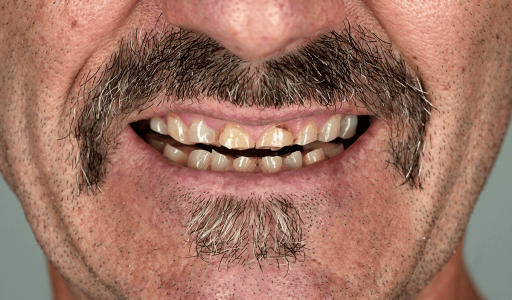 Russ_CloseUpBefore_1200px