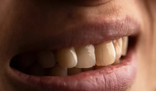 Tips-for-Dealing-with-Hairline-Cracks-in-Teeth-2048x1365