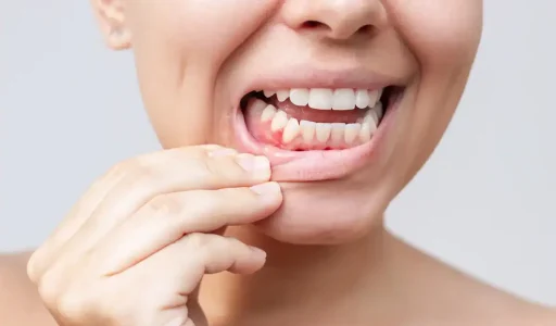 What-happens-when-you-ignore-a-cavity